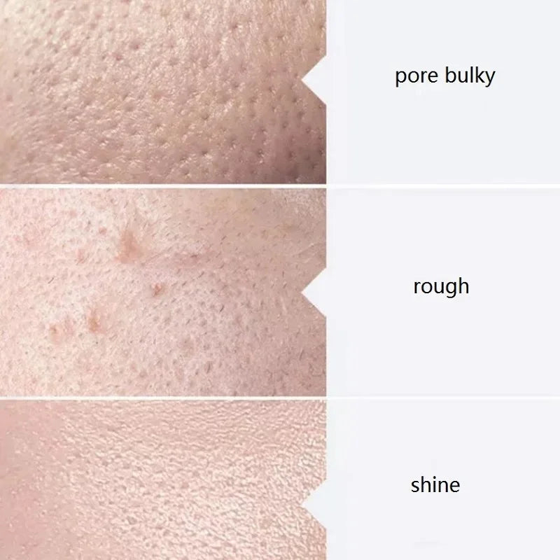 Aqua Peel Solution Serum Kit AS1 SA2 AO3 – Deep Skin Cleansing Facial Machine Solution 400ml